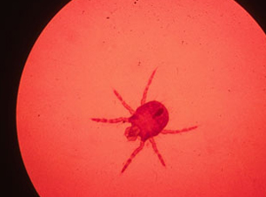 chigger under a microscope